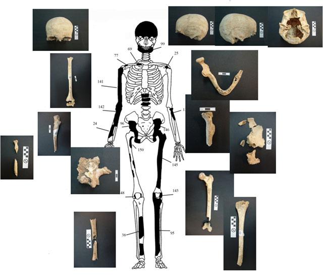 Μελέτη Σκελετικών Καταλοίπων Ταφικού Μνημείου, Λόφου Καστά, Αμφίπολη
